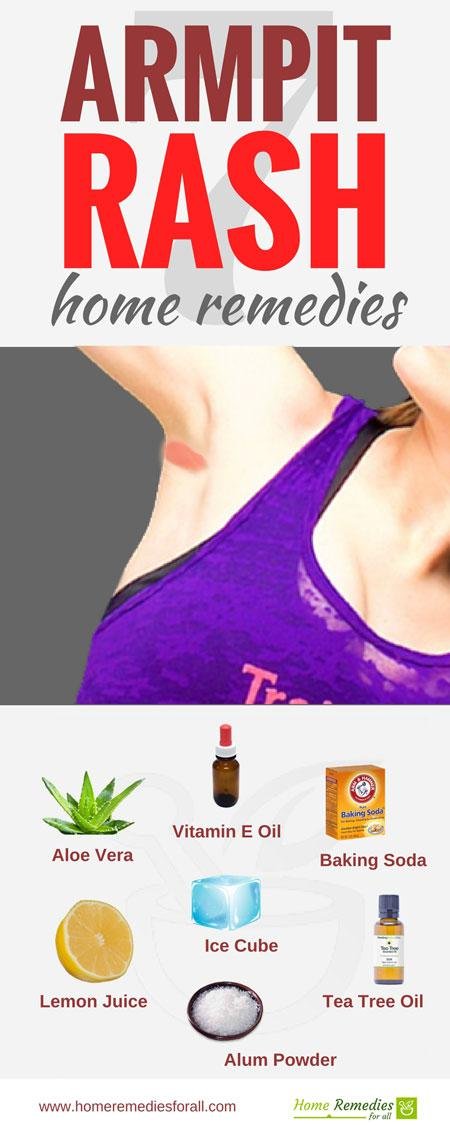 armpit rash remedies infographic