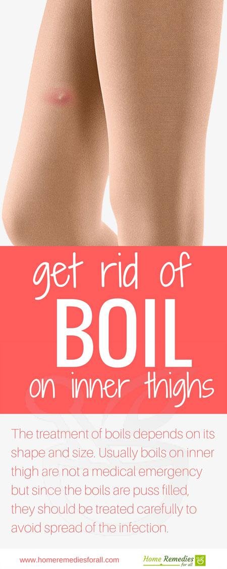 boil on inner thighs infographic
