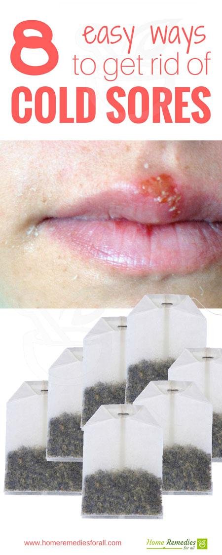 cold sore home remedies infographic