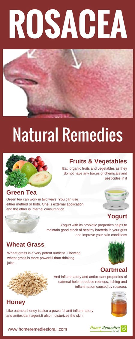 rosacea home remedies infographic