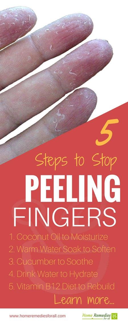 stop peeling fingers infographic