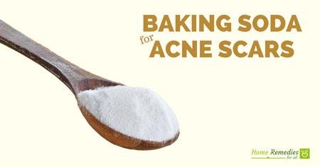 baking soda for acne scars