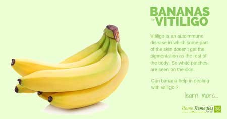 banana for vitiligo