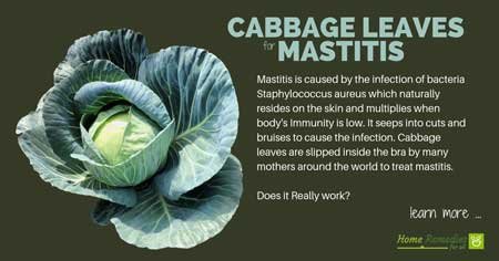 cabbage leaves for mastitis