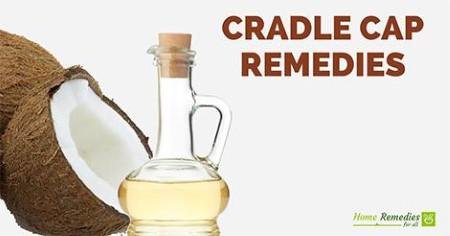 coconut oil for cradle cap