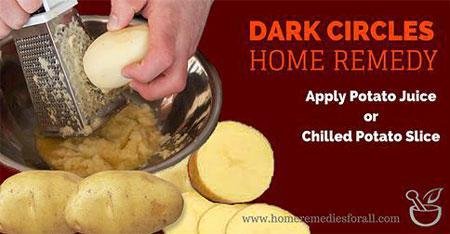 Picture of Home remedies for Dark Circles Potatoes