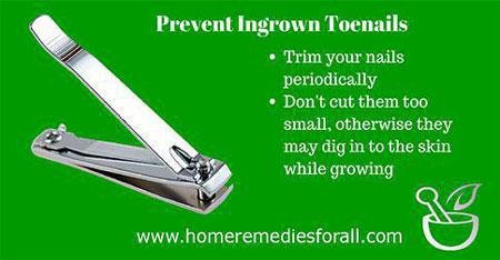 Picture of Home remedies for Ingrown Toenail Better Foot Hygeine 