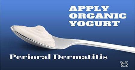 Perioral Dermatitis Cures Yogurt