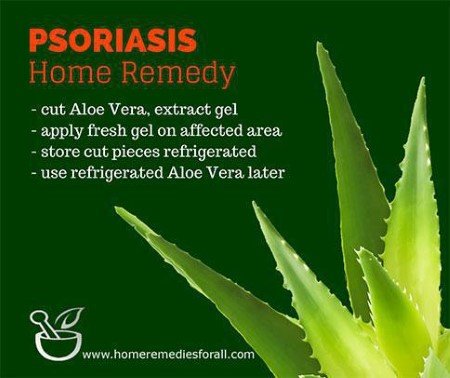 Psoriais Home Remedies Aloe Vera Gel