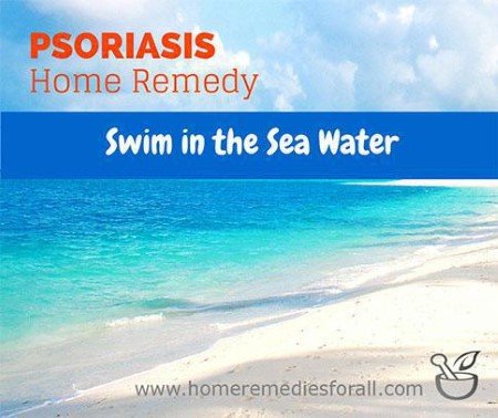 Psoriasis Home Remedies Sea Water Swimming