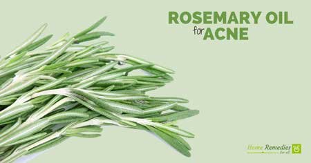 rosemary oil for acne