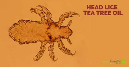 tea tree oil for head lice