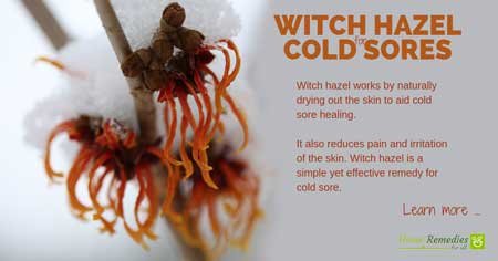 witch hazel for cold sores